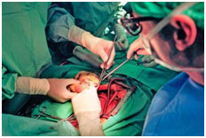 comment-se-deroule-une-transplantation-cardiaque