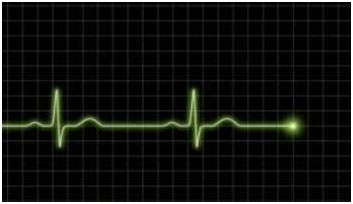 electrocardiogramme