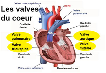 valvulopathies