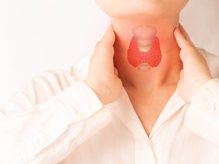 Femme palpant sa gorge illustrant les troubles de la thyroïde, l’hyperthyroïdie et leurs impacts sur la santé cardiovasculaire