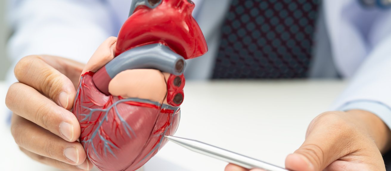 Médecin indiquant une zone précise sur un modèle de cœur illustrant un cathétérisme cardiaque droit