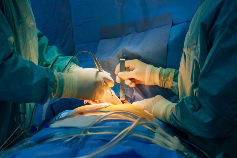 Intervention chirurgicale cardiaque illustrant une chirurgie de l’aorte