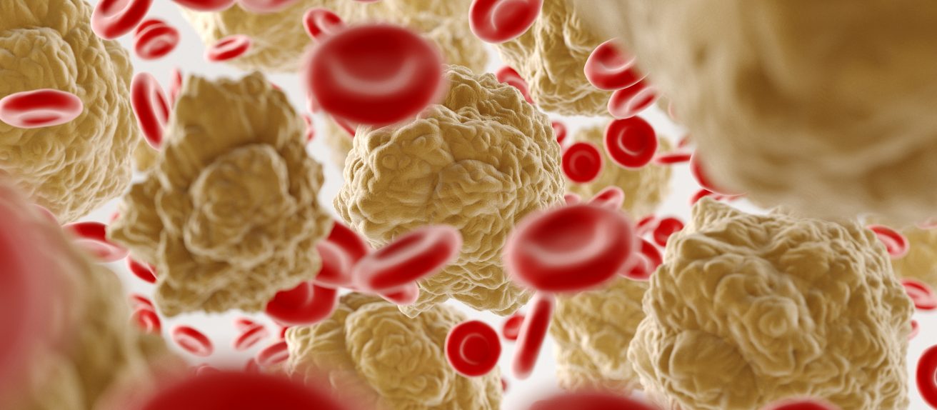Illustration de globules rouges et dépôts de cholestérol dans une artère