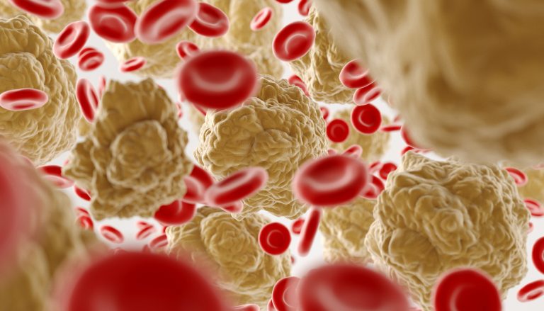 Illustration de globules rouges et dépôts de cholestérol dans une artère