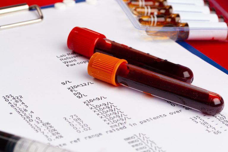 Résultat d’analyse sanguine illustrant le dosage de la troponine