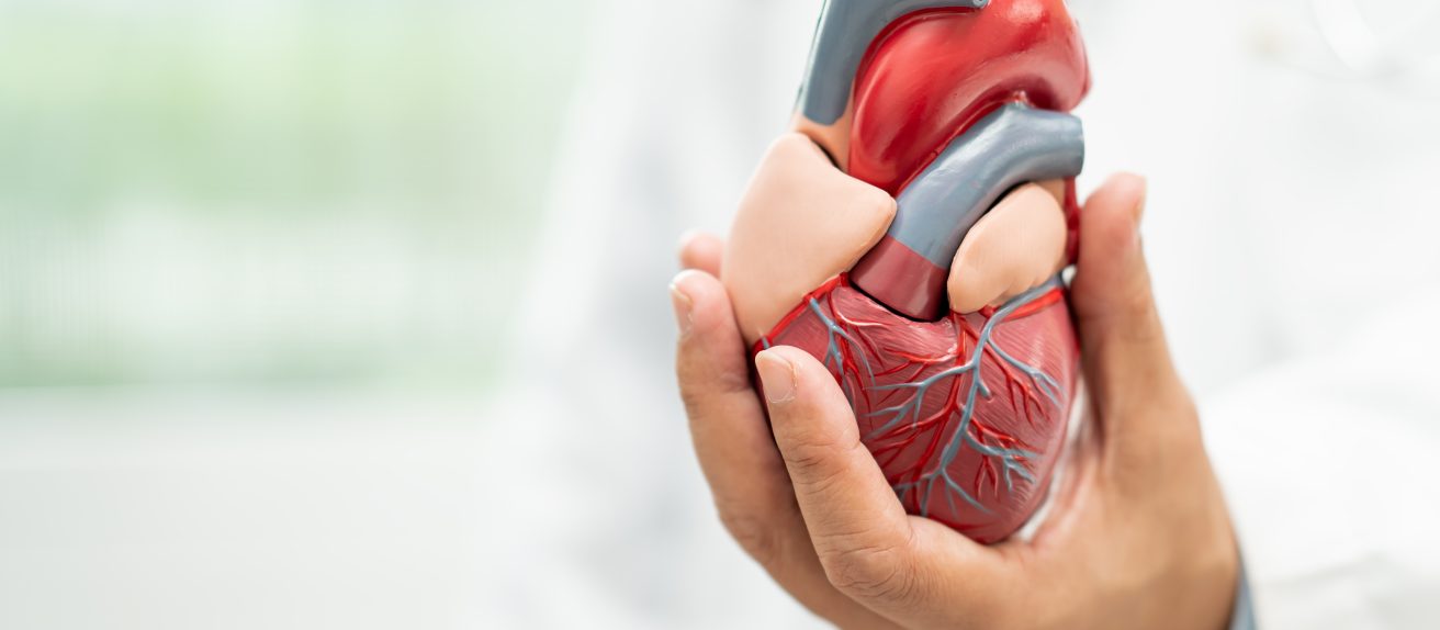 Médecin tenant une maquette de cœur illustrant une implantation valvulaire aortique par cathéter (TAVI)