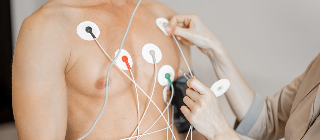 Homme portant des électrodes sur la poitrine pour un enregistrement ECG Holter