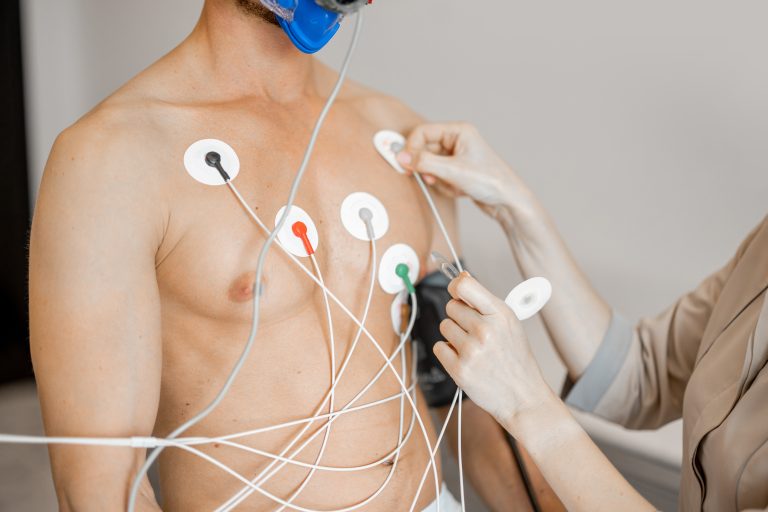 Homme portant des électrodes sur la poitrine pour un enregistrement ECG Holter